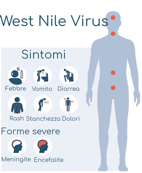 west nile fever sintomi